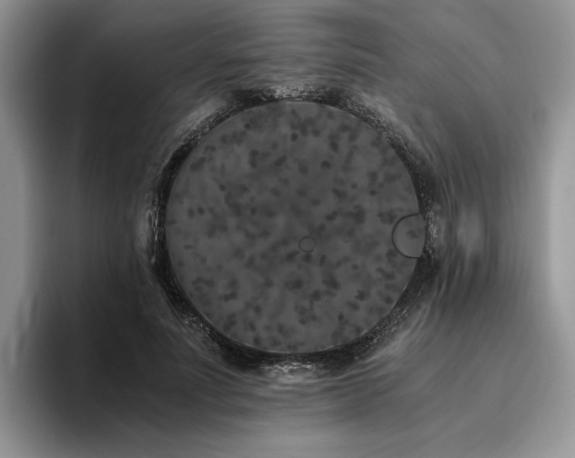 X0000096140691200801181133