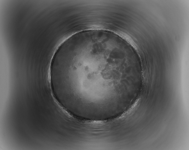 X0000096140839200801181131