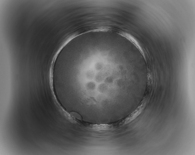 X0000096140859200801181131