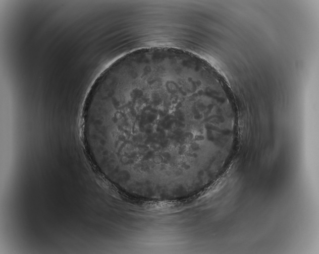 X0000096140879200801181130