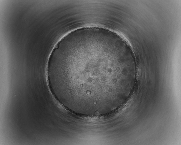 X0000096140895200801181130