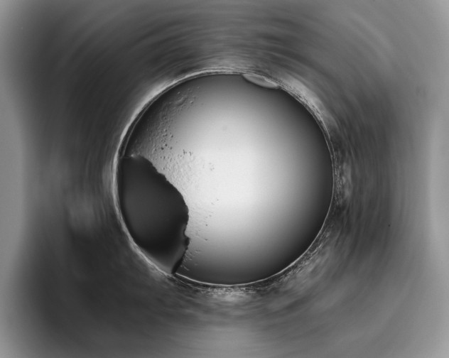 X0000096141103200801181127