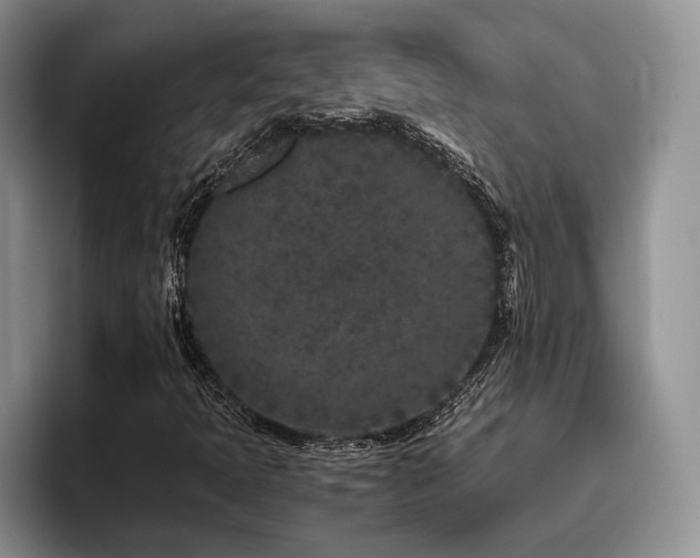 X0000096141397200801181123