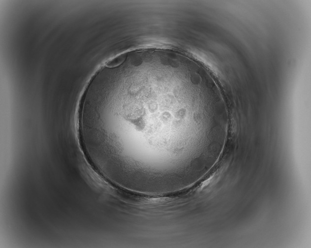 X0000096141471200801181123