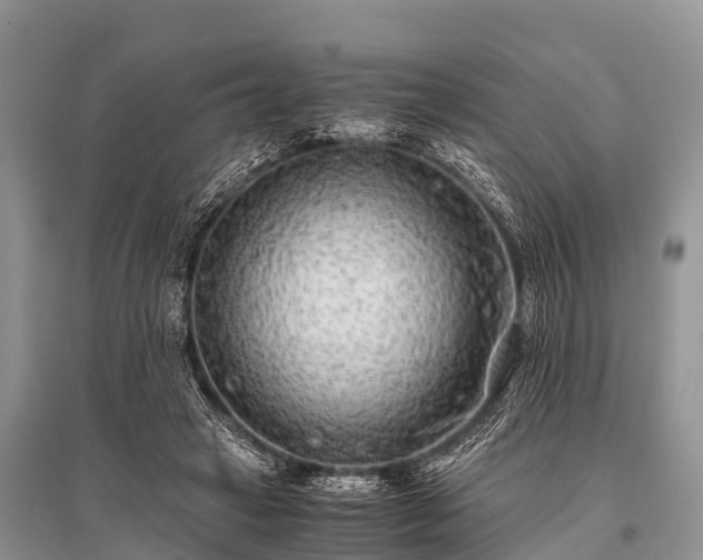 X0000096140449200801251045