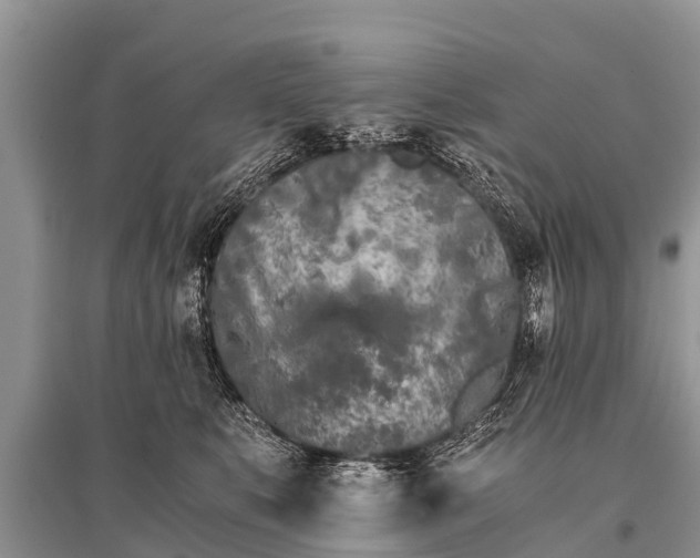 X0000096140519200801251044
