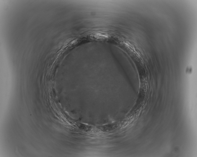 X0000096141009200801251036