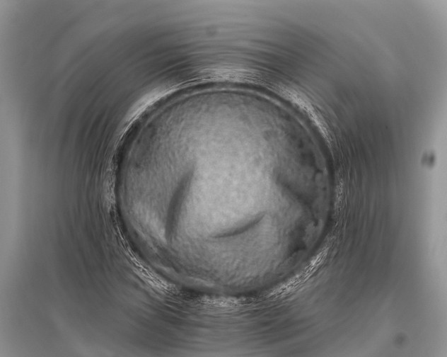 X0000096141019200801251036
