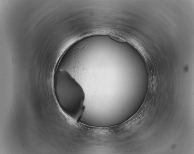 X0000096141103200801251035