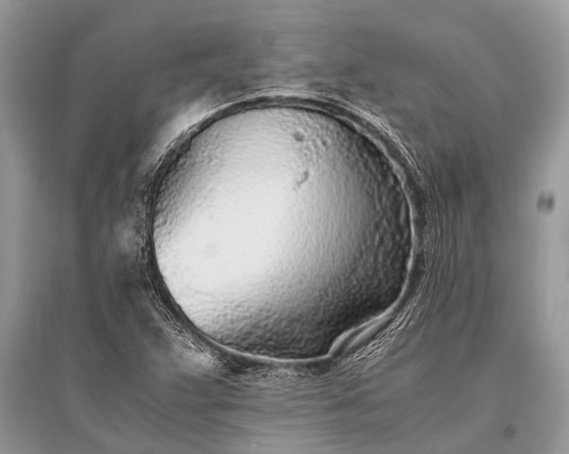 X0000096141359200801251031