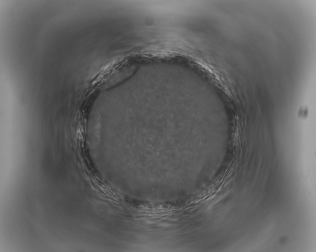 X0000096141397200801251030