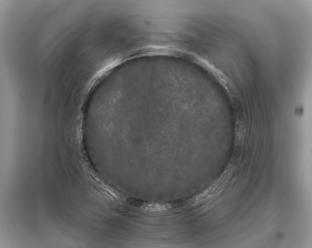 X0000096141411200801251030