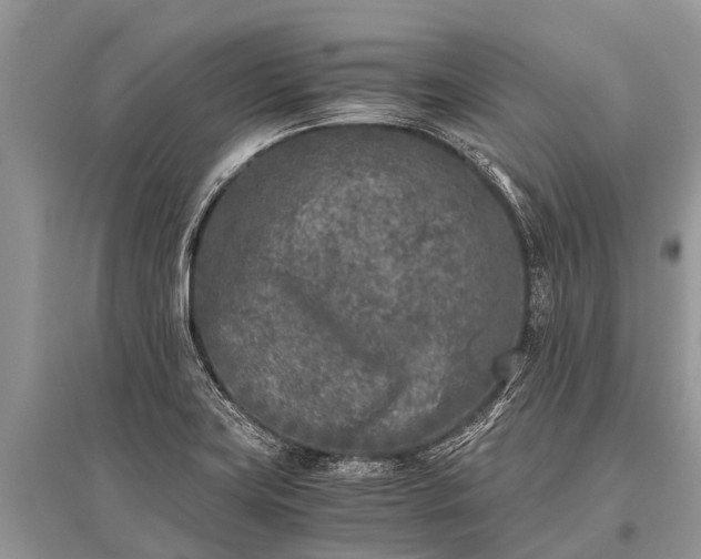 X0000096141419200801251030