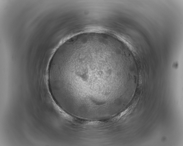X0000096141471200801251029