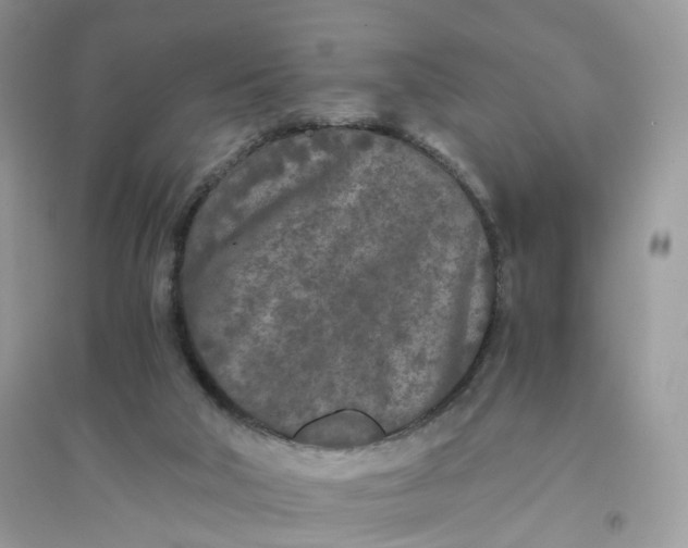 X0000096140018200802011221