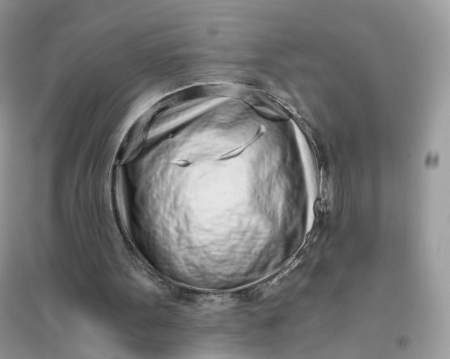 X0000096140099200802011219