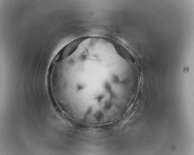 X0000096140292200802011217