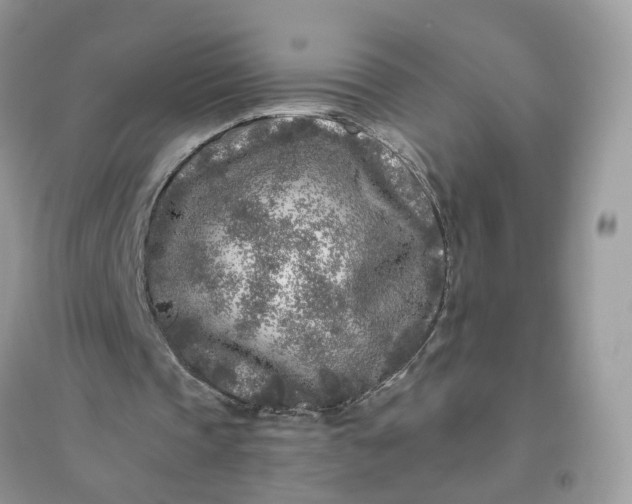 X0000096140337200802011215