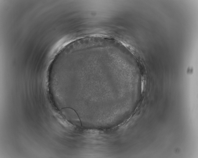 X0000096140339200802011215