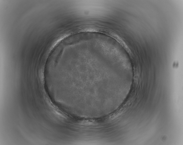 X0000096140386200802011215