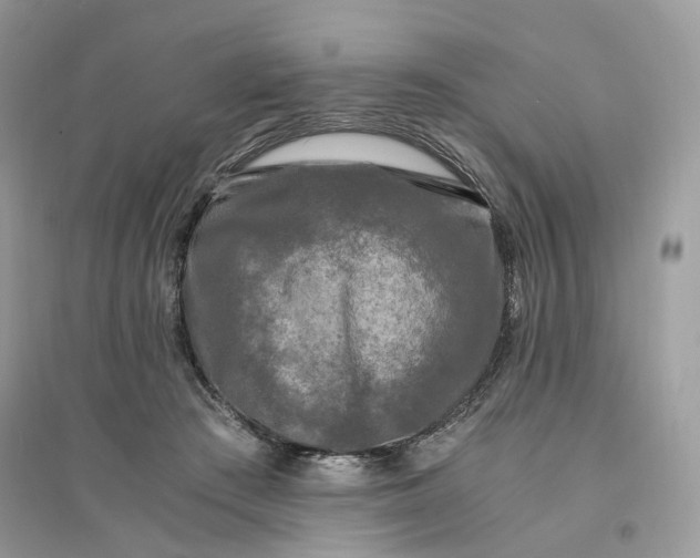 X0000096140409200802011215