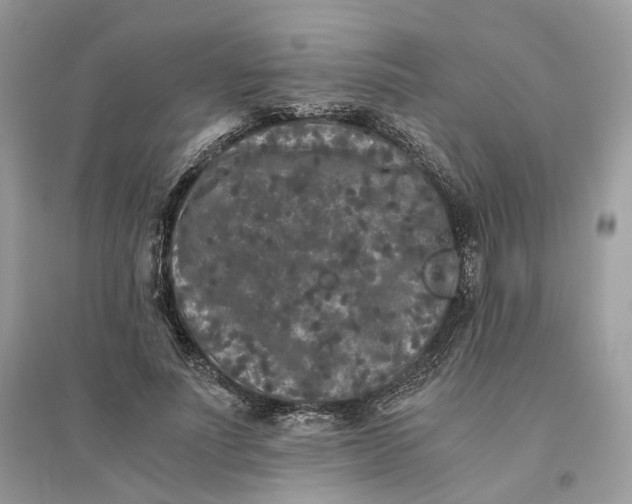 X0000096140691200802011211