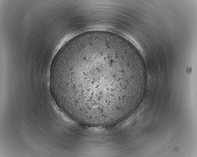 X0000096140994200802011206