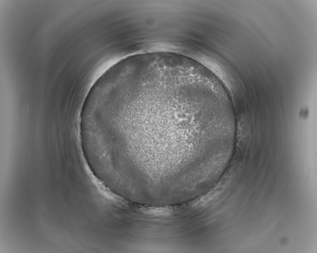 X0000096141047200802011206