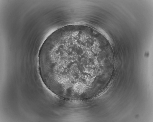 X0000096141095200802011205