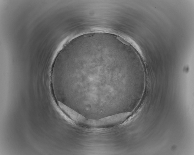 X0000096141381200802011201