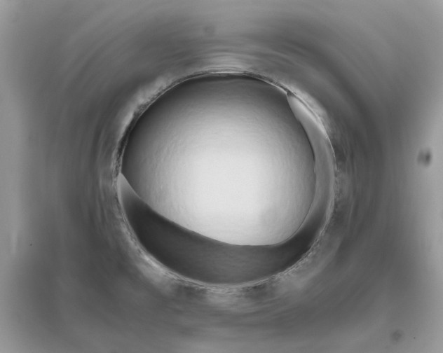 X0000096141477200802011159