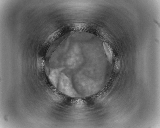 X0000096140276200802081355