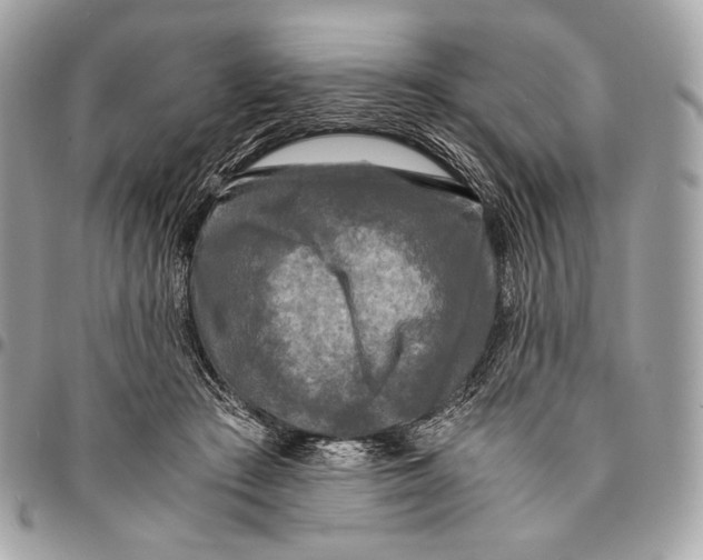 X0000096140409200802081353