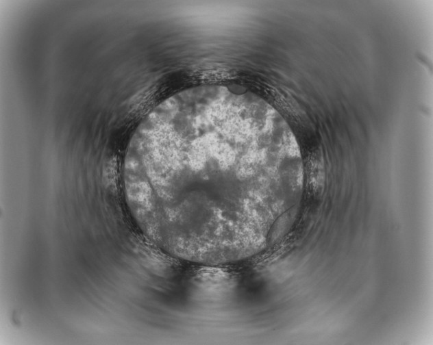 X0000096140519200802081351