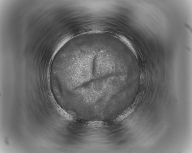 X0000096140859200802081346