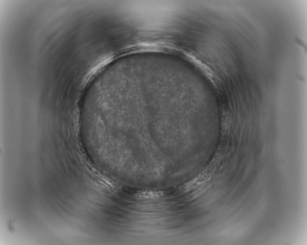 X0000096141411200802081337