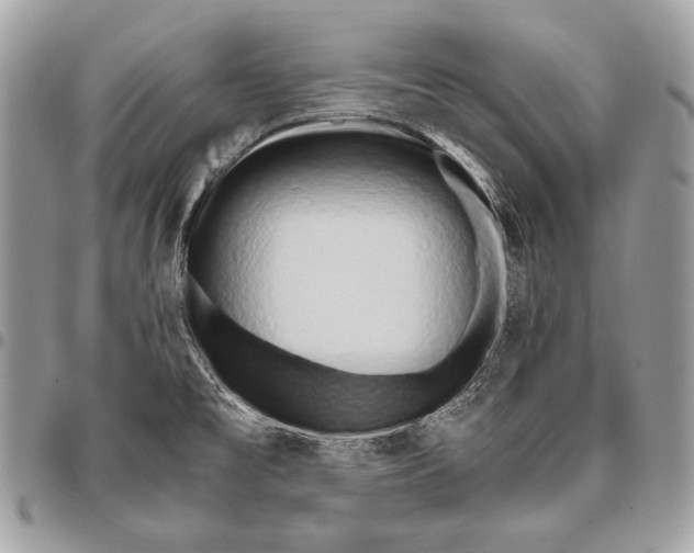 X0000096141477200802081337