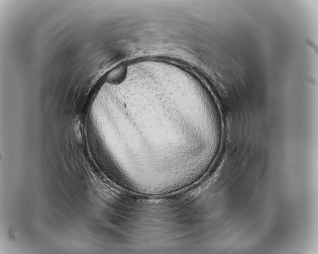 X0000096141497200802081336