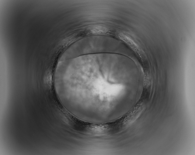X0000096140405200802151338