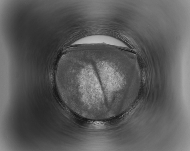 X0000096140409200802151338