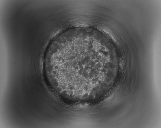 X0000096140491200802151337