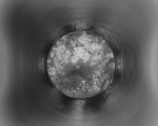 X0000096140519200802151337