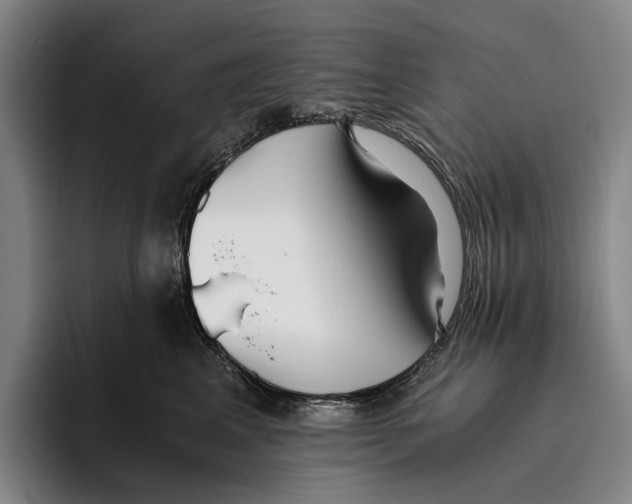 X0000096140617200802151335
