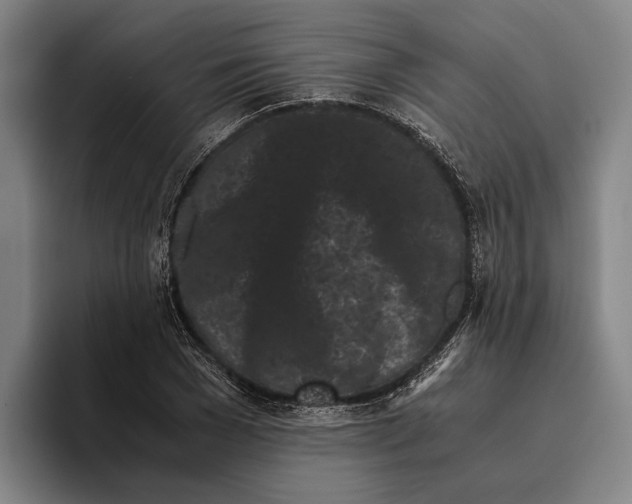 X0000096140977200802151331