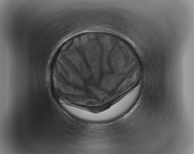 X0000096141506200802151323