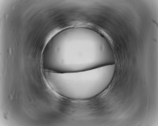 X0000096151487200801180818