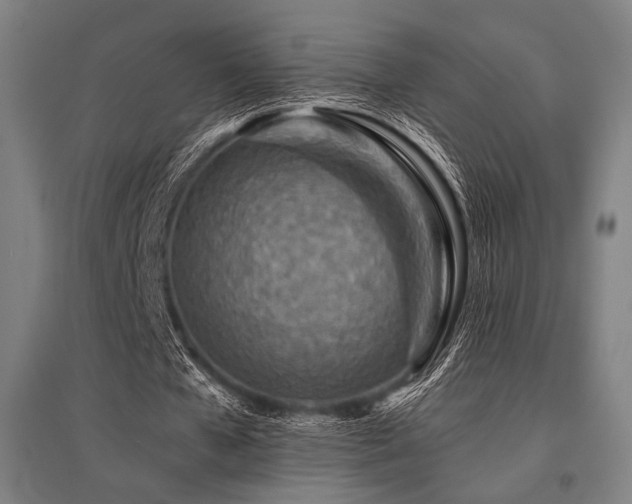 X0000096150577200801181204