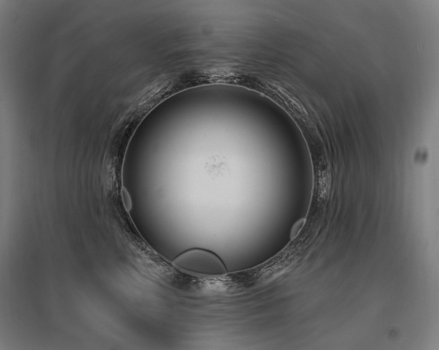 X0000096150618200801181204
