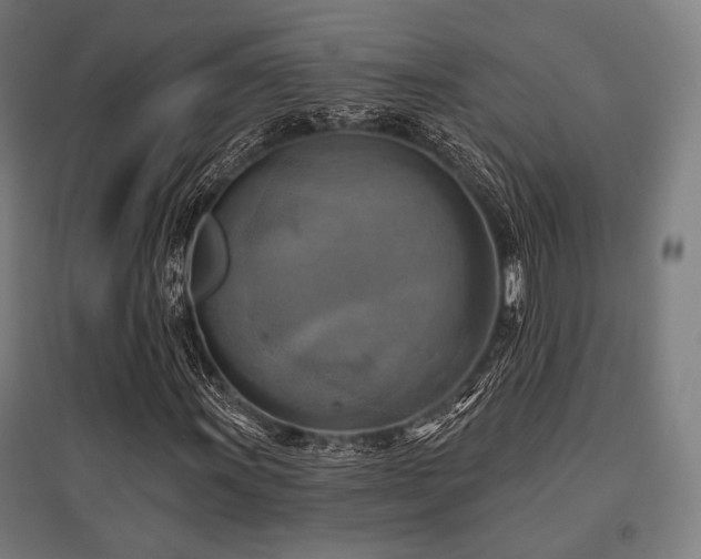 X0000096151011200801181157