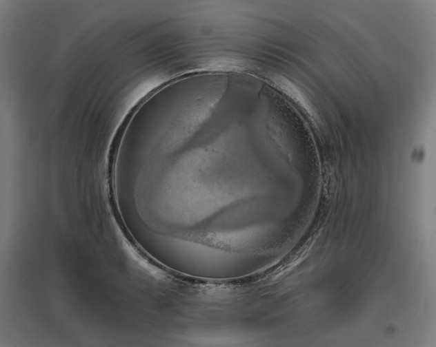 X0000096151087200801181157